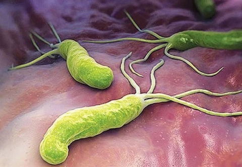 Vi khuẩn Helicobacter pylori (H. pylori) và viêm dạ dày